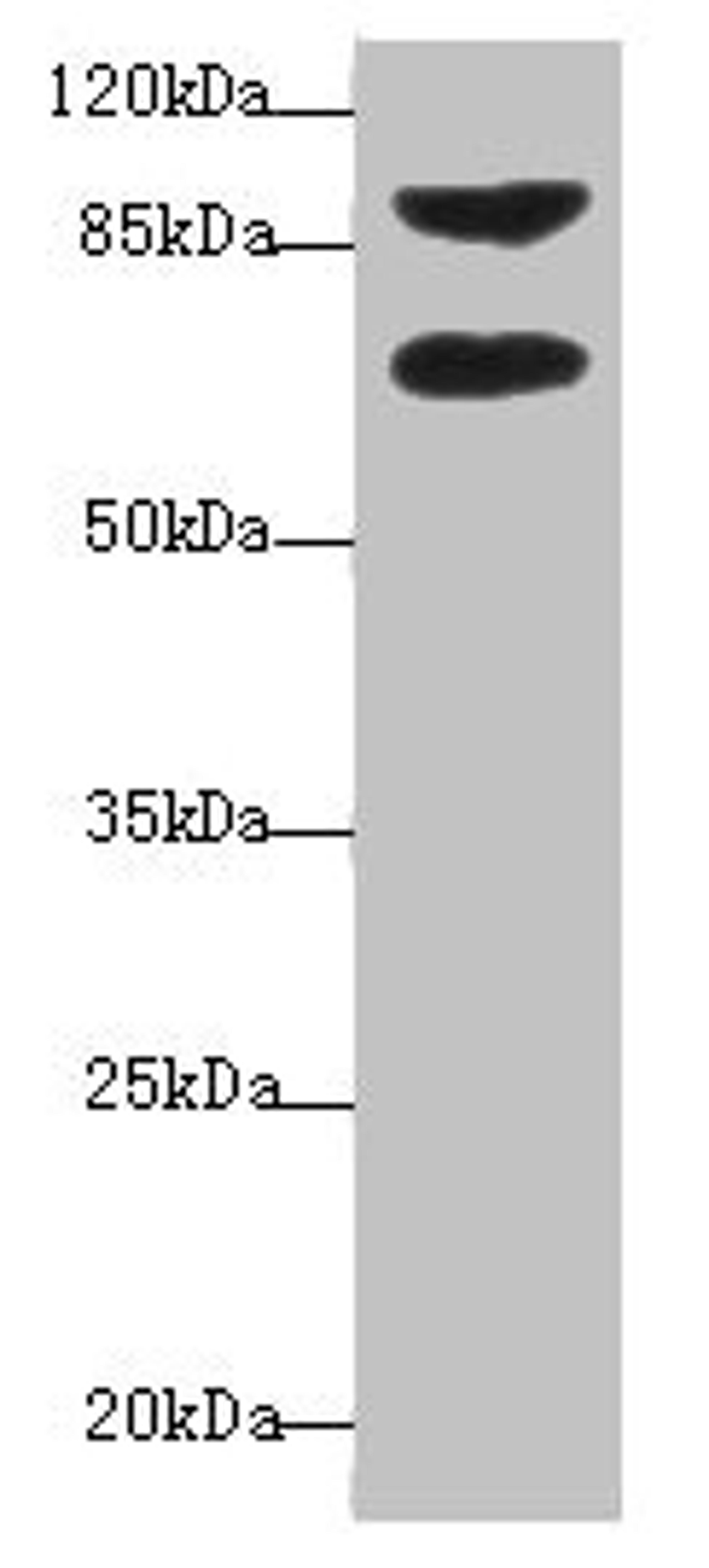 Western blot. All lanes: DTX2 antibody at 1ug/ml + HepG2 whole cell lysate. Secondary. Goat polyclonal to rabbit IgG at 1/10000 dilution. Predicted band size: 68, 63 kDa. Observed band size: 68, 92 kDa. 