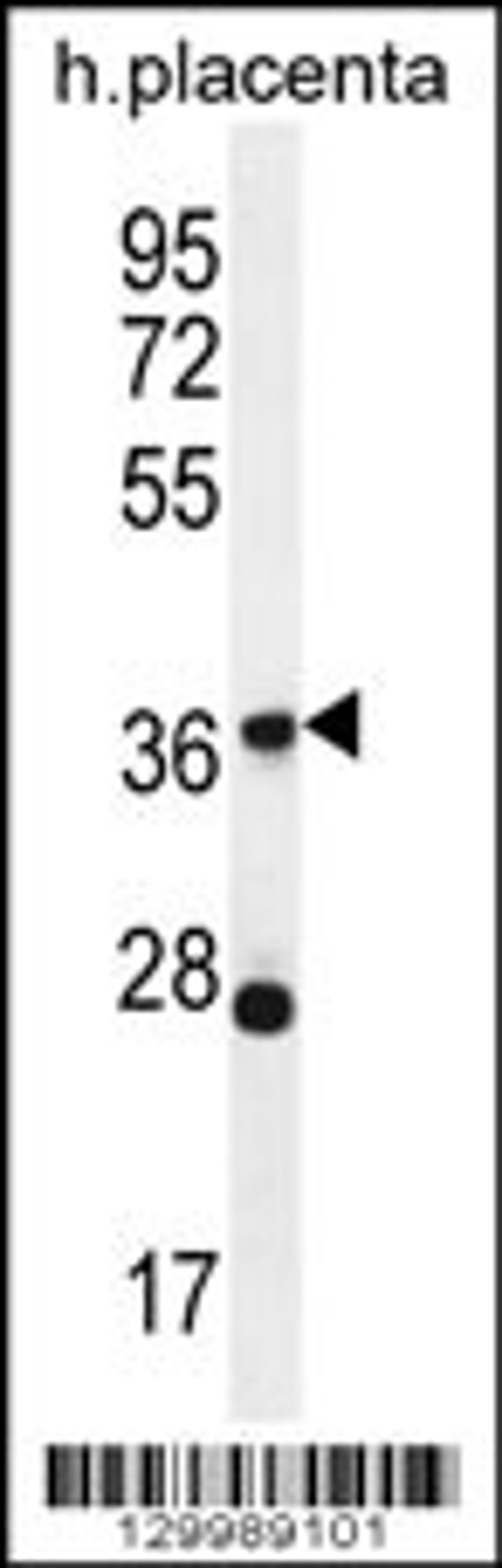 Western blot analysis in human placenta tissue lysates (35ug/lane).