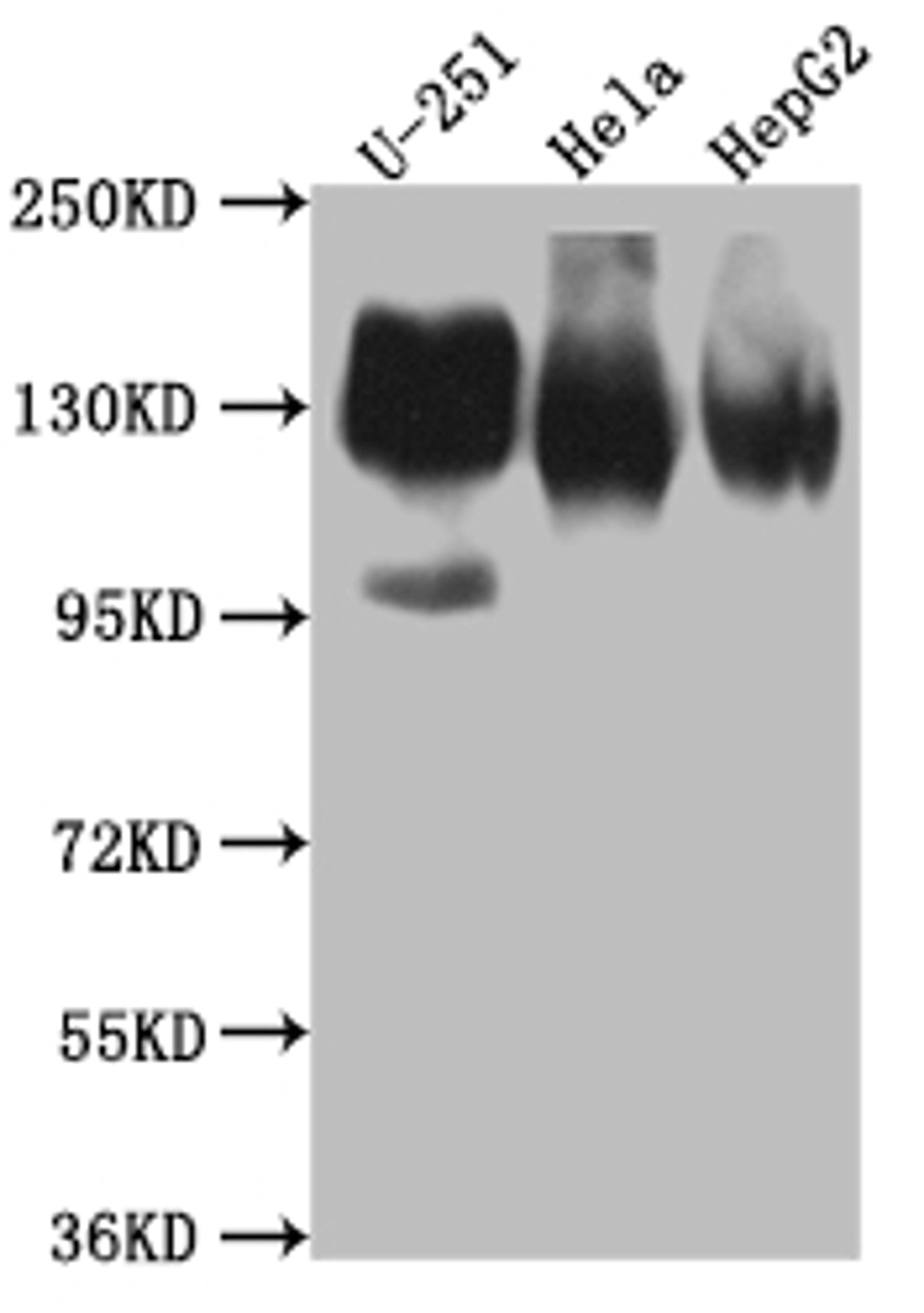 Western Blot. Positive WB detected in: U-251 whole cell lysate, Hela whole cell lysate, HepG2 whole cell lysate. All lanes: ITGAV antibody at 1:1000. Secondary. Goat polyclonal to rabbit IgG at 1/50000 dilution. Predicted band size: 117, 113, 112 kDa. Observed band size: 130 kDa. 