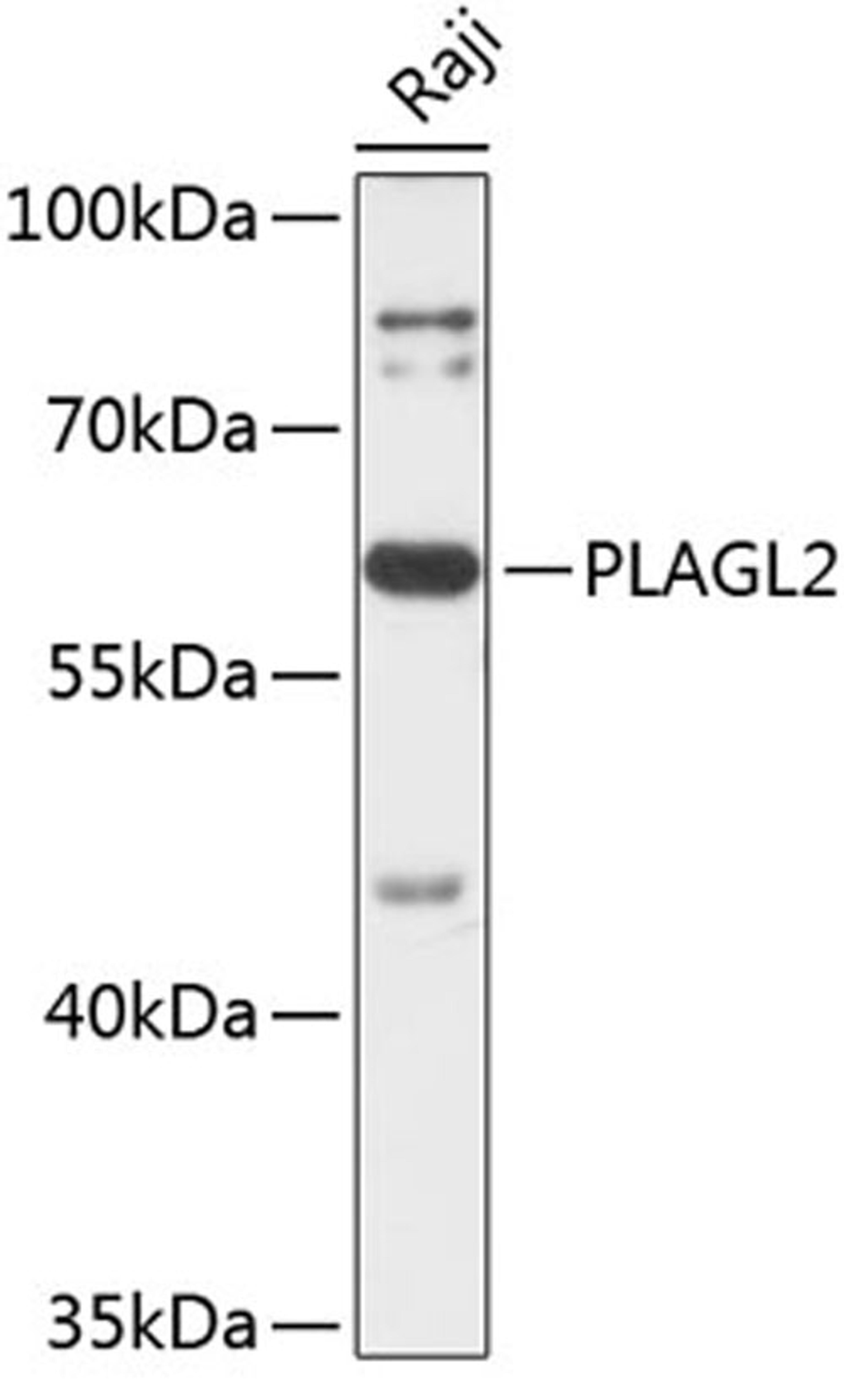 Western blot - PLAGL2 antibody (A14318)