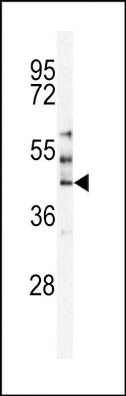 Western blot analysis of MST3 Antibody in HepG2 cell line lysates (35ug/lane)