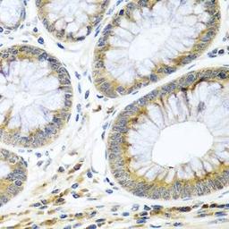 Immunohistochemical staining of rat lung tissue using WNT9A antibody (dilution of 1:100)