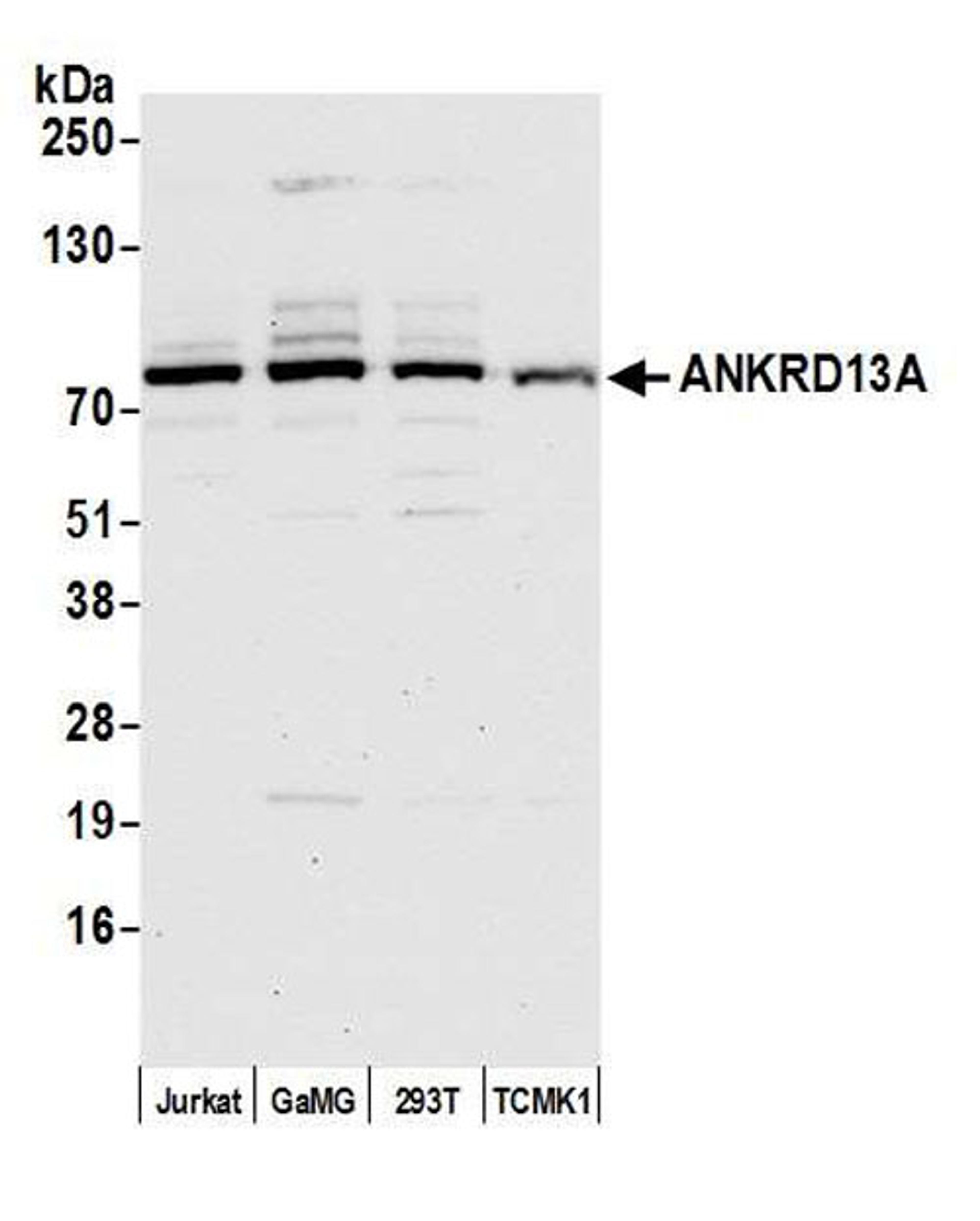 Detection of human and mouse ANKRD13A by WB.