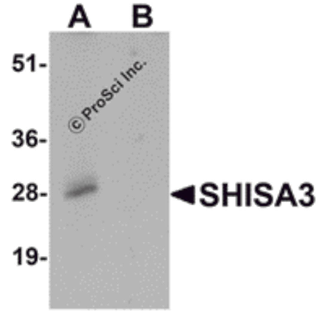 Western blot analysis of SHISA3 in human small intestine Tissue lysate with SHISA3 antibody at 1 μg/mL in (A) the absence and (B) the presence of blocking peptide.