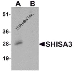 Western blot analysis of SHISA3 in human small intestine Tissue lysate with SHISA3 antibody at 1 μg/mL in (A) the absence and (B) the presence of blocking peptide.