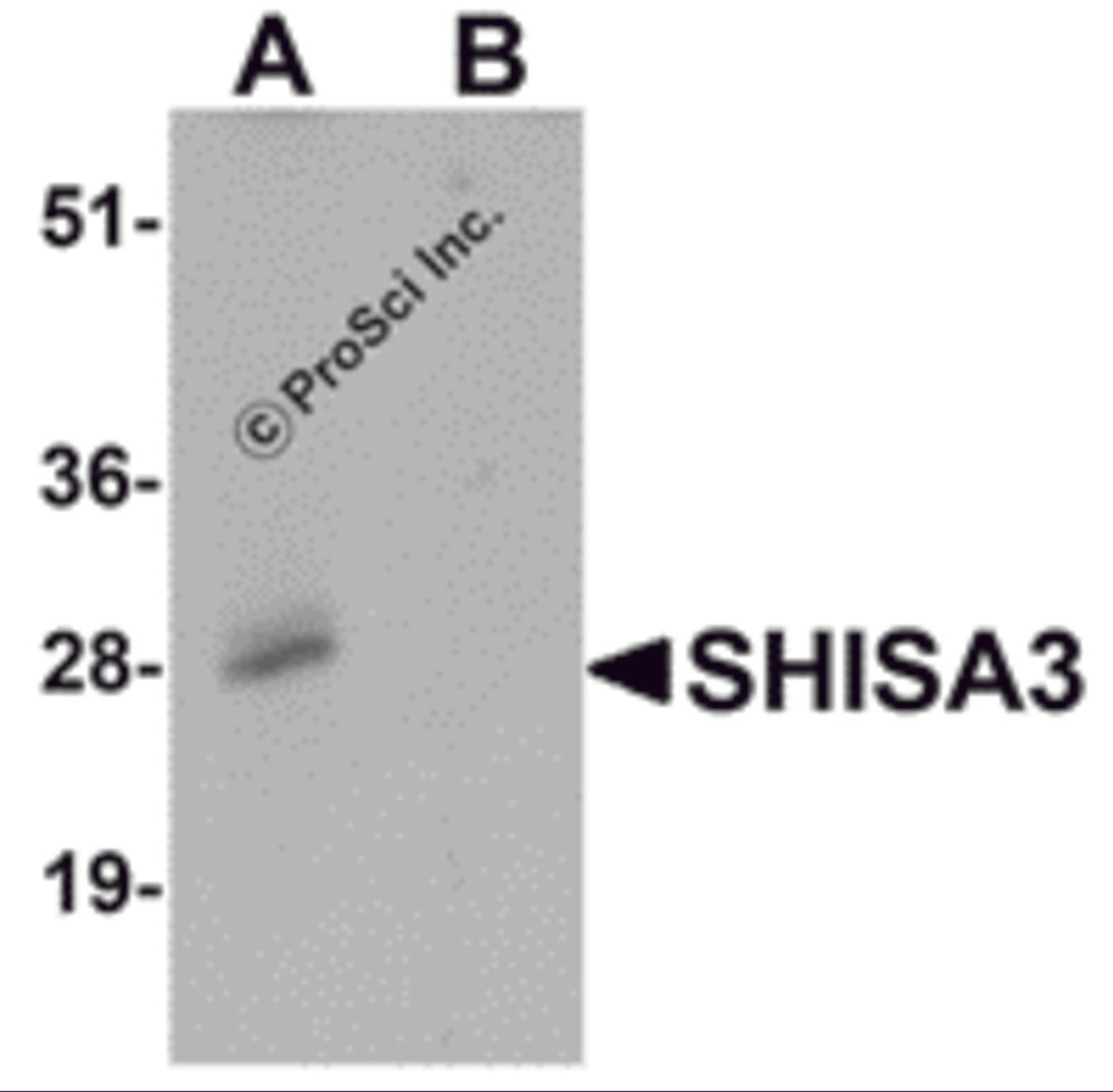 Western blot analysis of SHISA3 in human small intestine Tissue lysate with SHISA3 antibody at 1 μg/mL in (A) the absence and (B) the presence of blocking peptide.