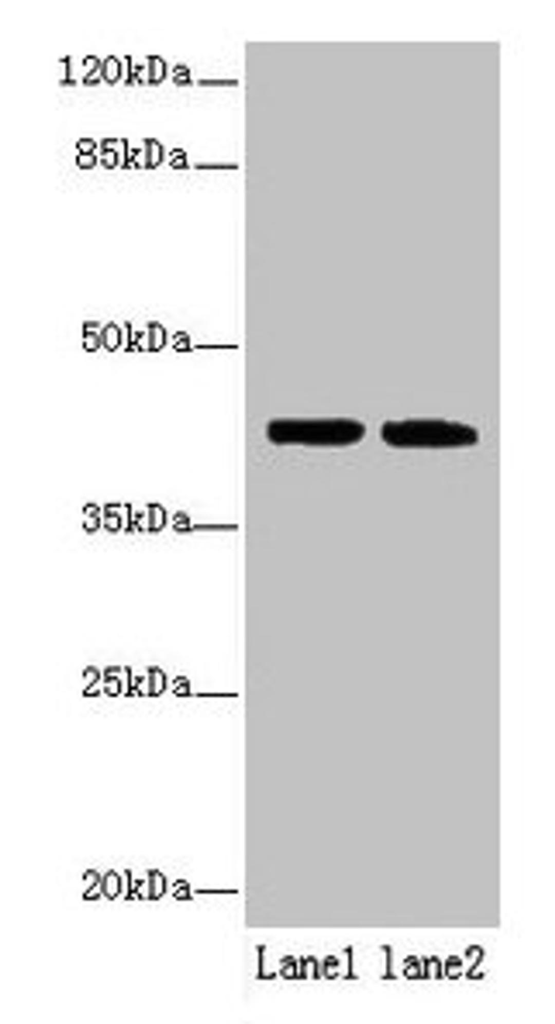 Western blot. All lanes: SDF4 antibody at 6µg/ml. Lane 1: U87 whole cell lysate. Lane 2: Jurkat whole cell lysate. Secondary. Goat polyclonal to rabbit IgG at 1/10000 dilution. Predicted band size: 42, 31, 28, 24, 16, 40 kDa. Observed band size: 42 kDa