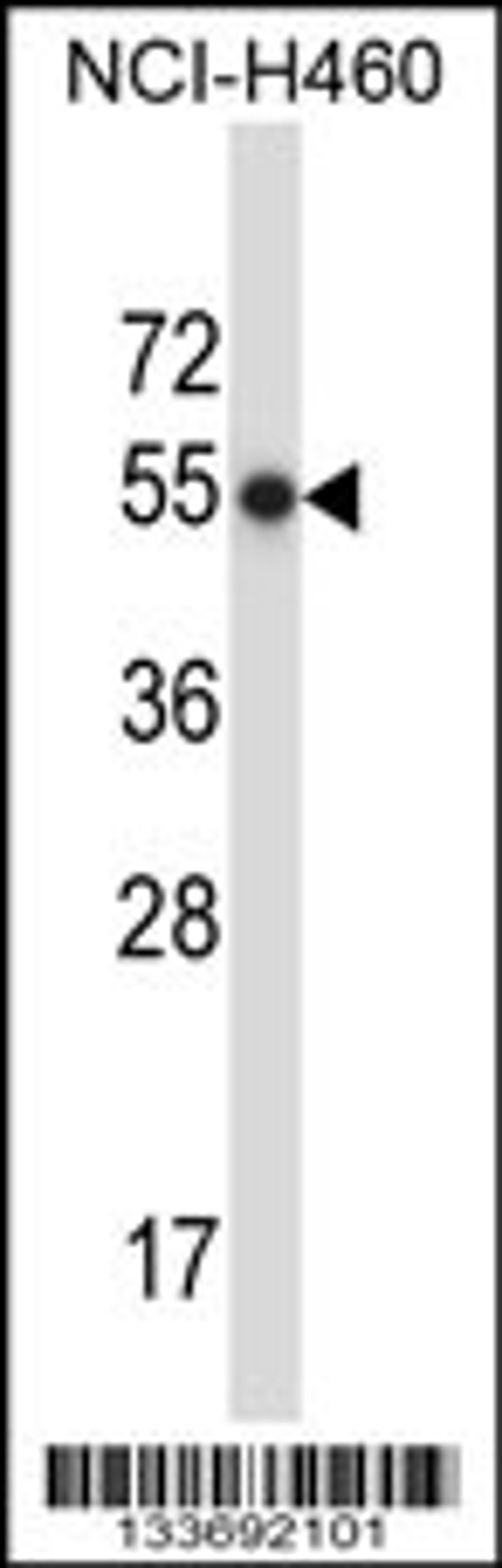 Western blot analysis in NCI-H460 cell line lysates (35ug/lane).