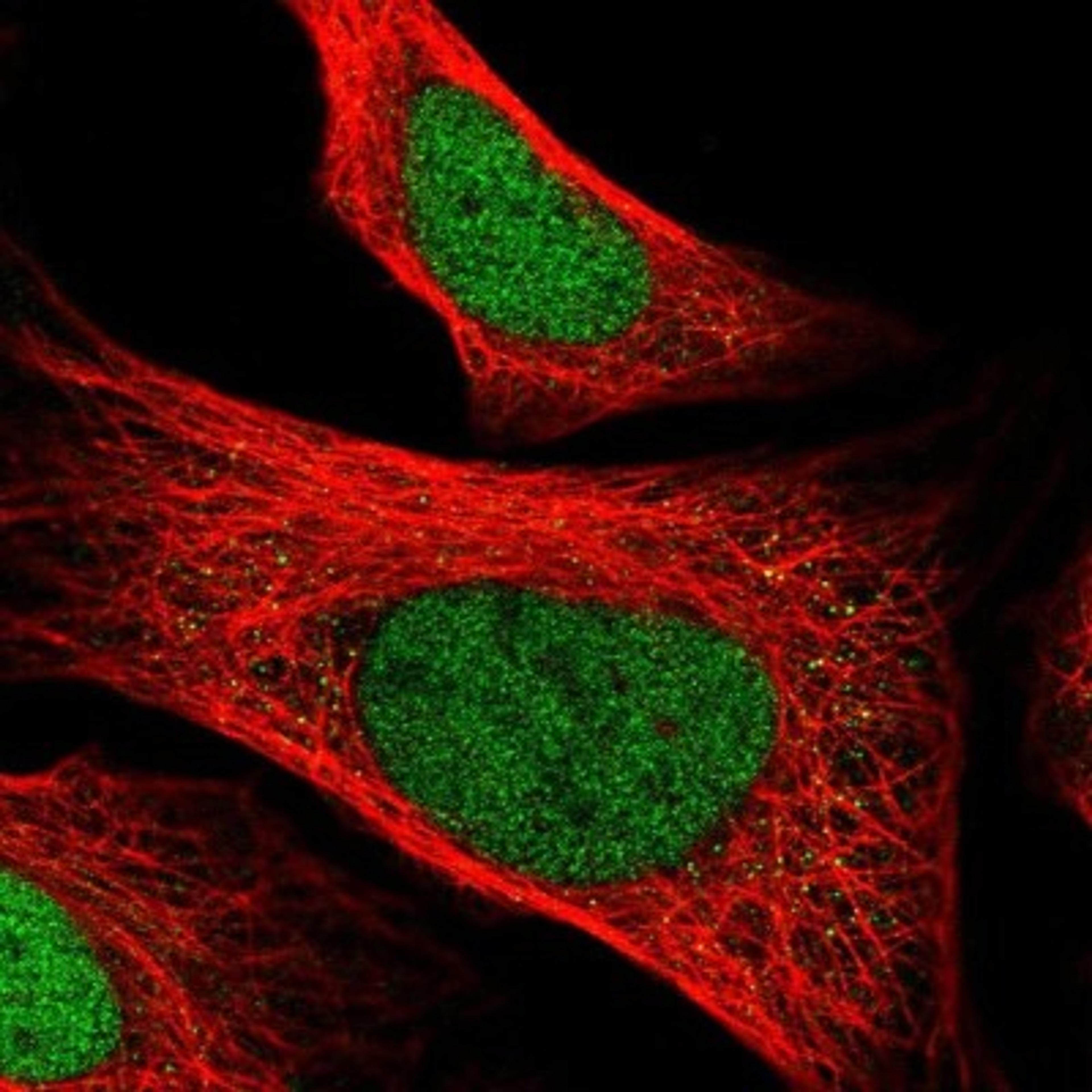 Immunocytochemistry/Immunofluorescence: ZNF707 Antibody [NBP1-92642] - Staining of human cell line U-2 OS shows positivity in nucleus but not nucleoli.