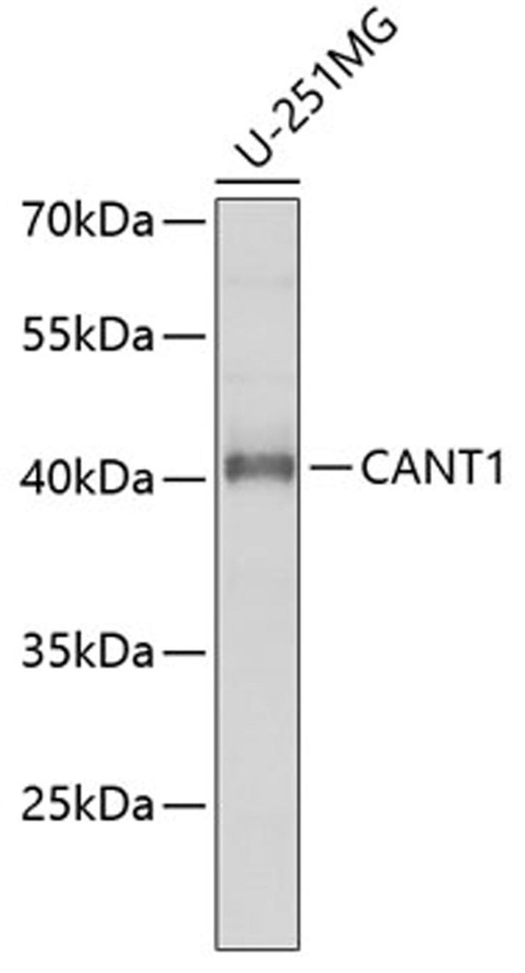 Western blot - CANT1 antibody (A6341)