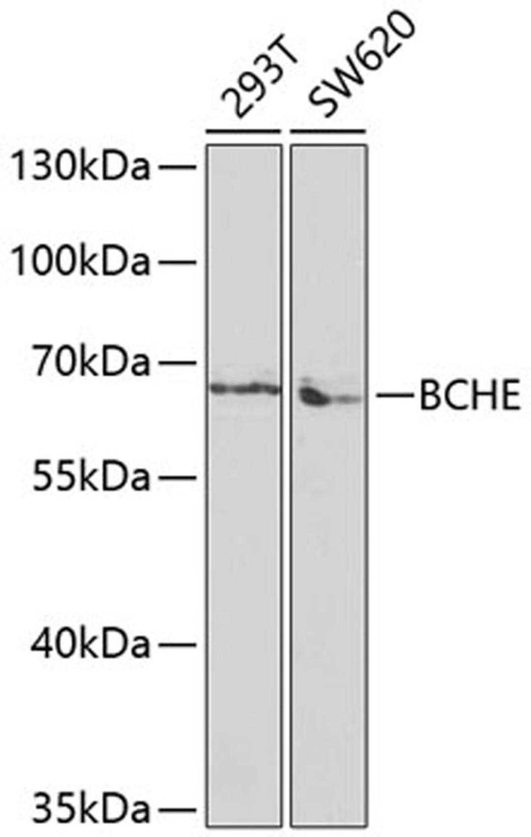 Western blot - BCHE antibody (A1460)