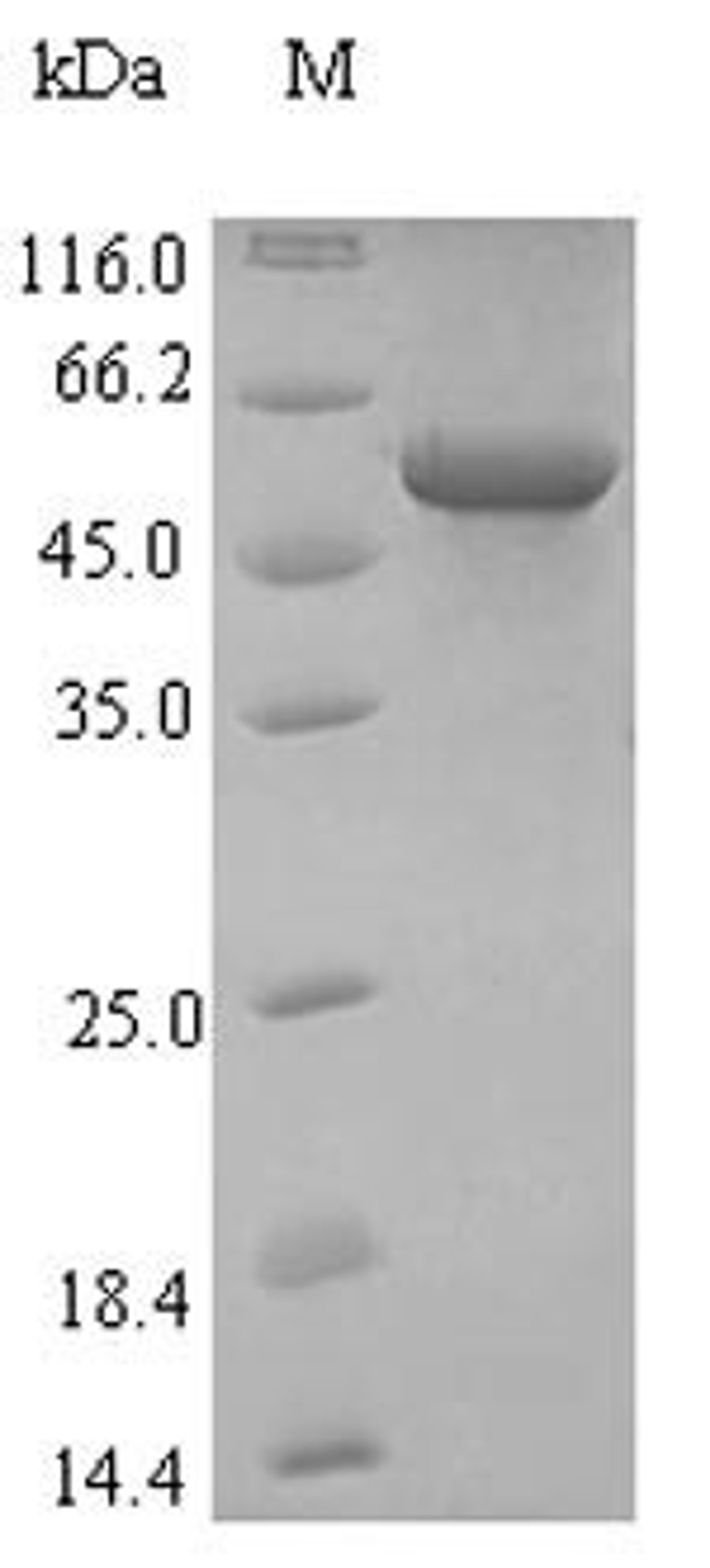 (Tris-Glycine gel) Discontinuous SDS-PAGE (reduced) with 5% enrichment gel and 15% separation gel.