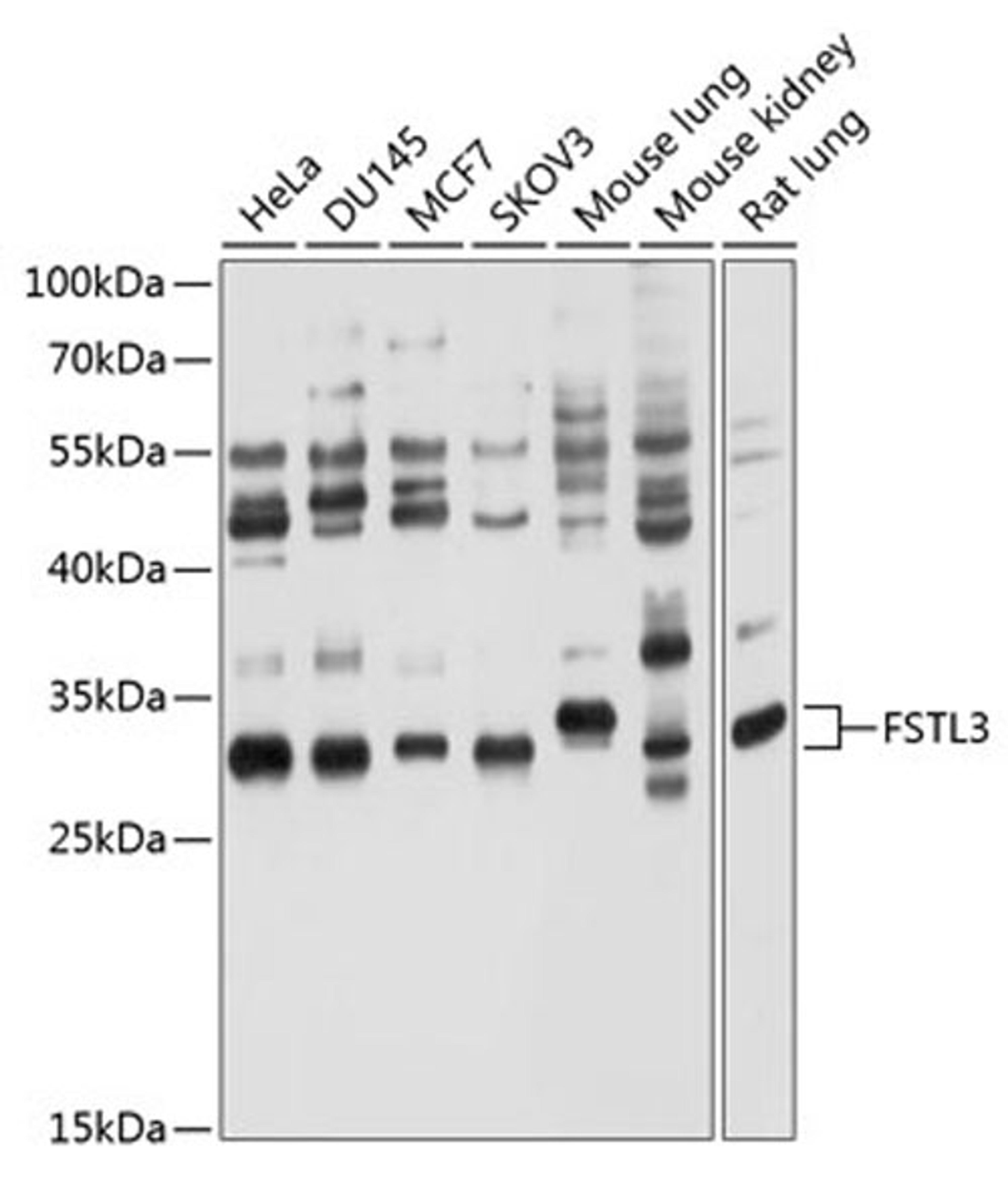 Western blot - FSTL3 antibody (A10279)