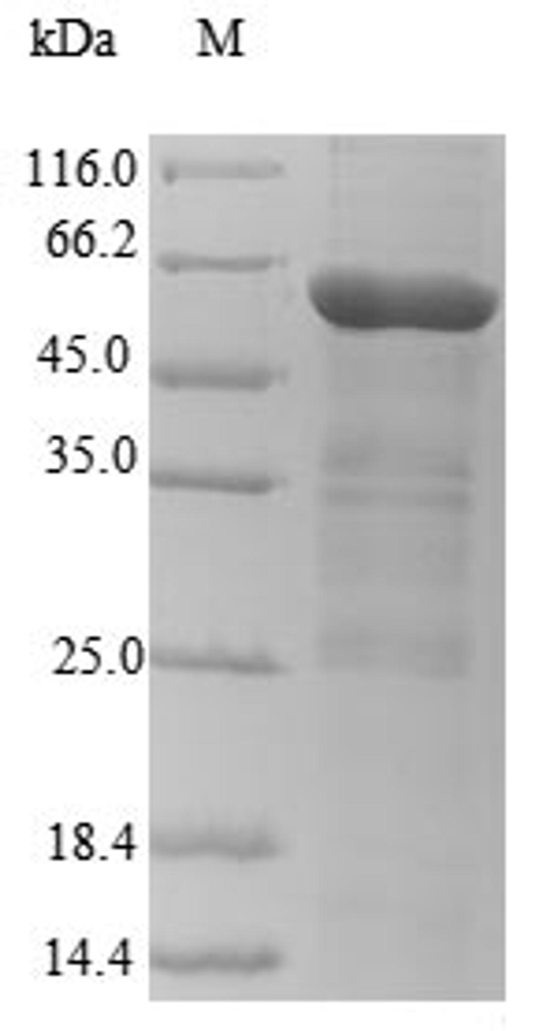 (Tris-Glycine gel) Discontinuous SDS-PAGE (reduced) with 5% enrichment gel and 15% separation gel.