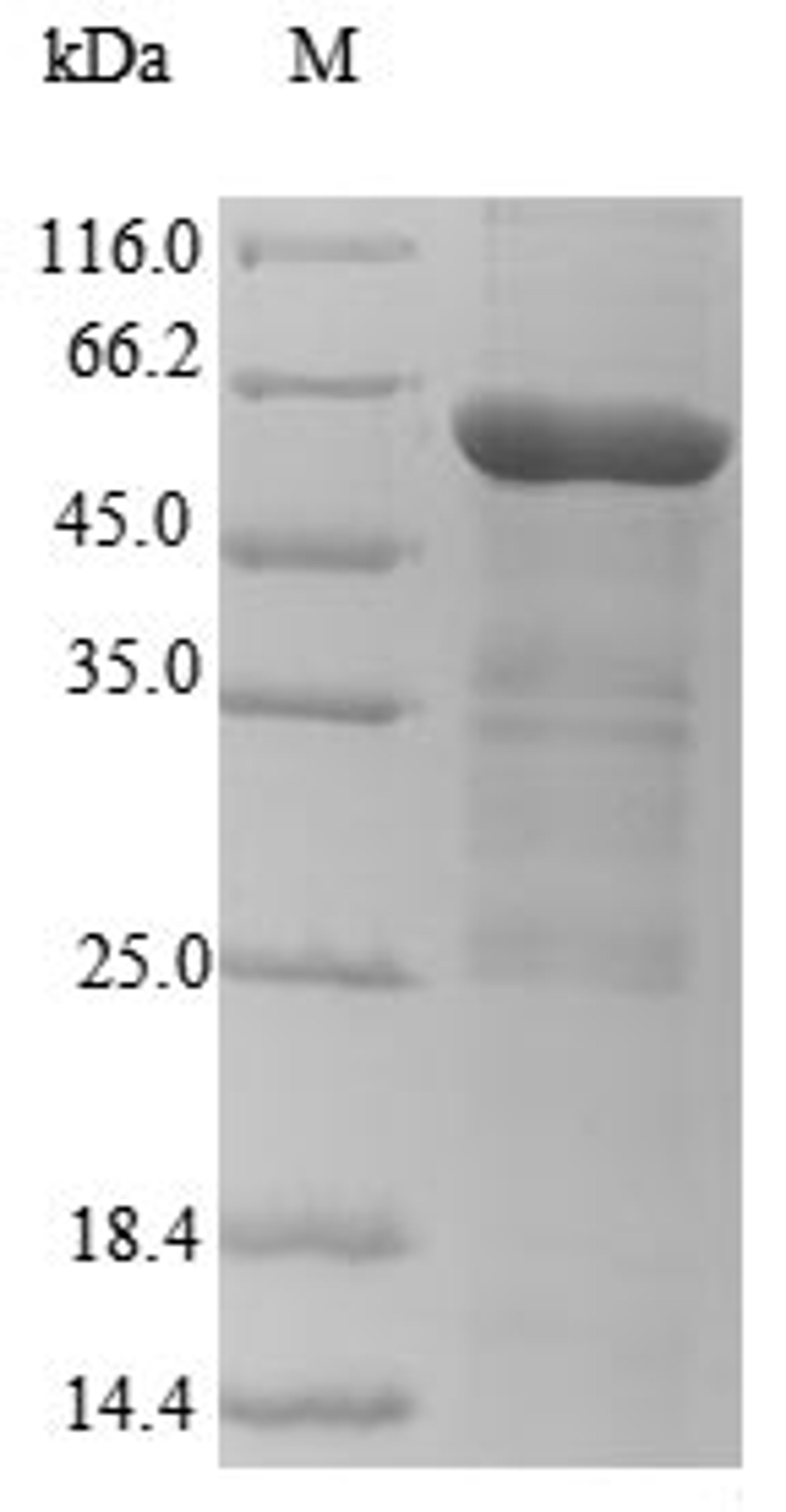 (Tris-Glycine gel) Discontinuous SDS-PAGE (reduced) with 5% enrichment gel and 15% separation gel.