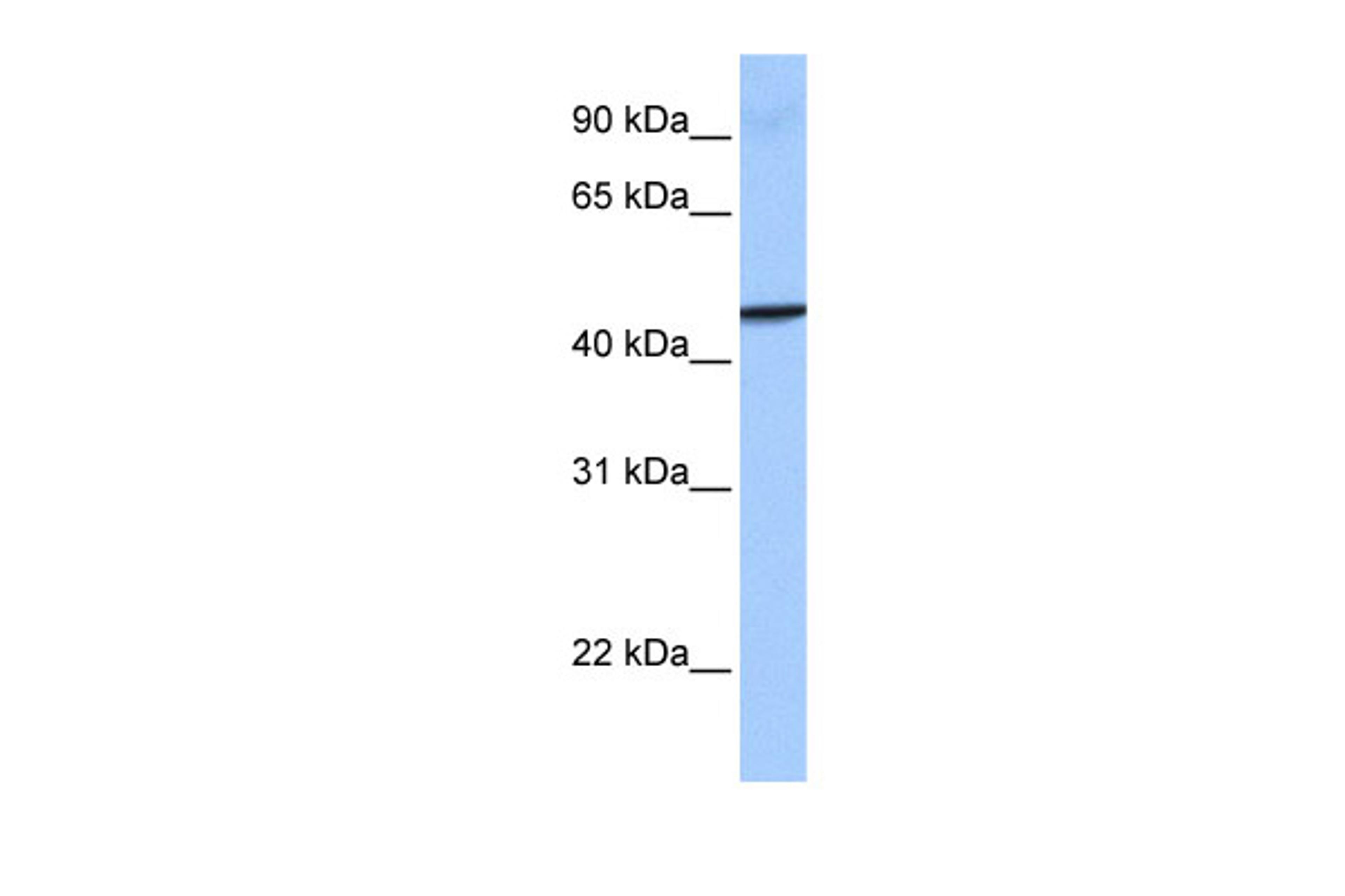 Antibody used in WB on Human Placenta at 0.2-1 ug/ml.