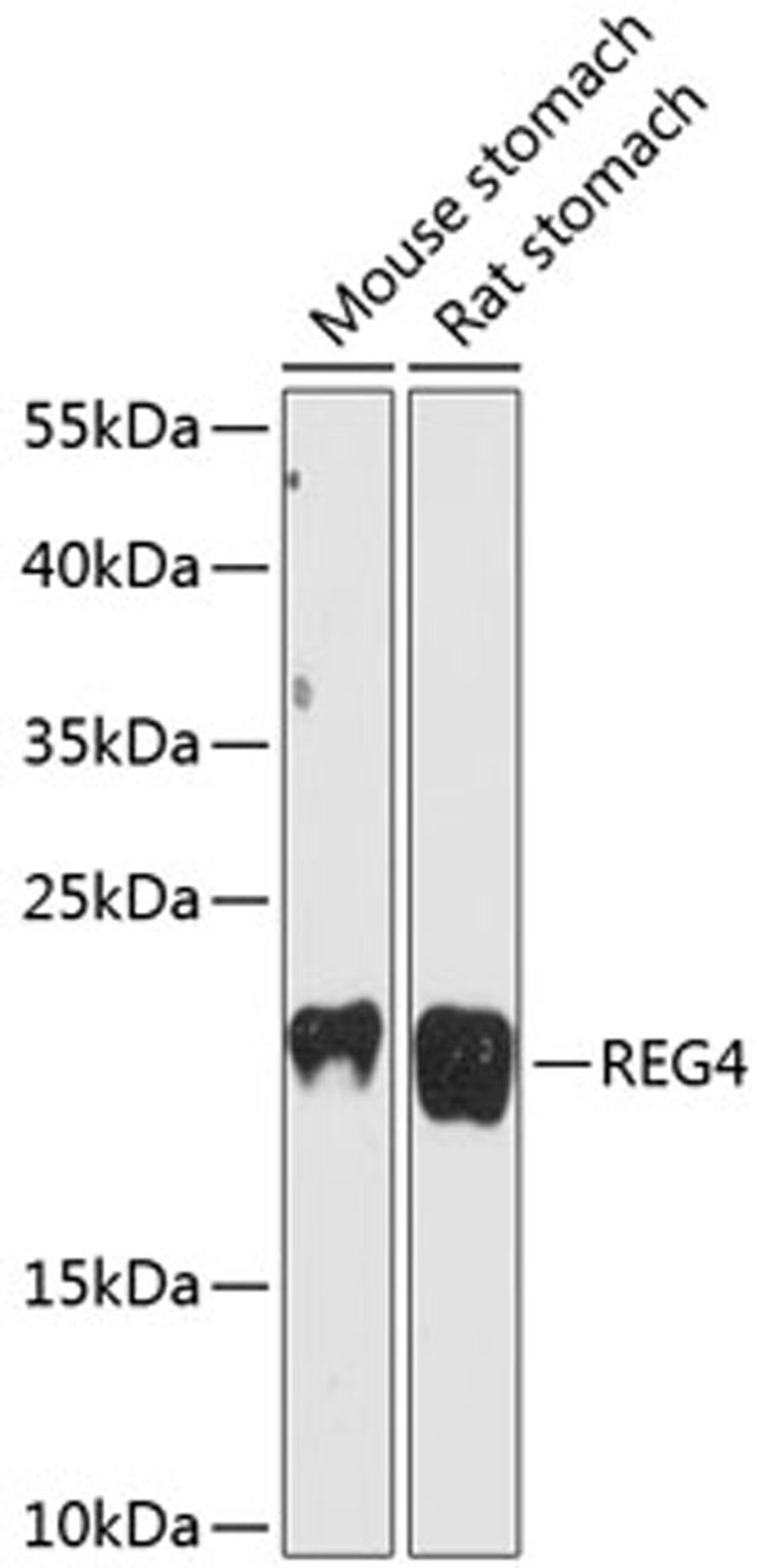 Western blot - REG4 antibody (A13129)