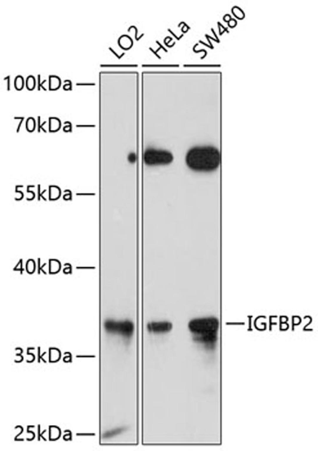 Western blot - IGFBP2 antibody (A0403)