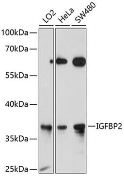 Western blot - IGFBP2 antibody (A0403)