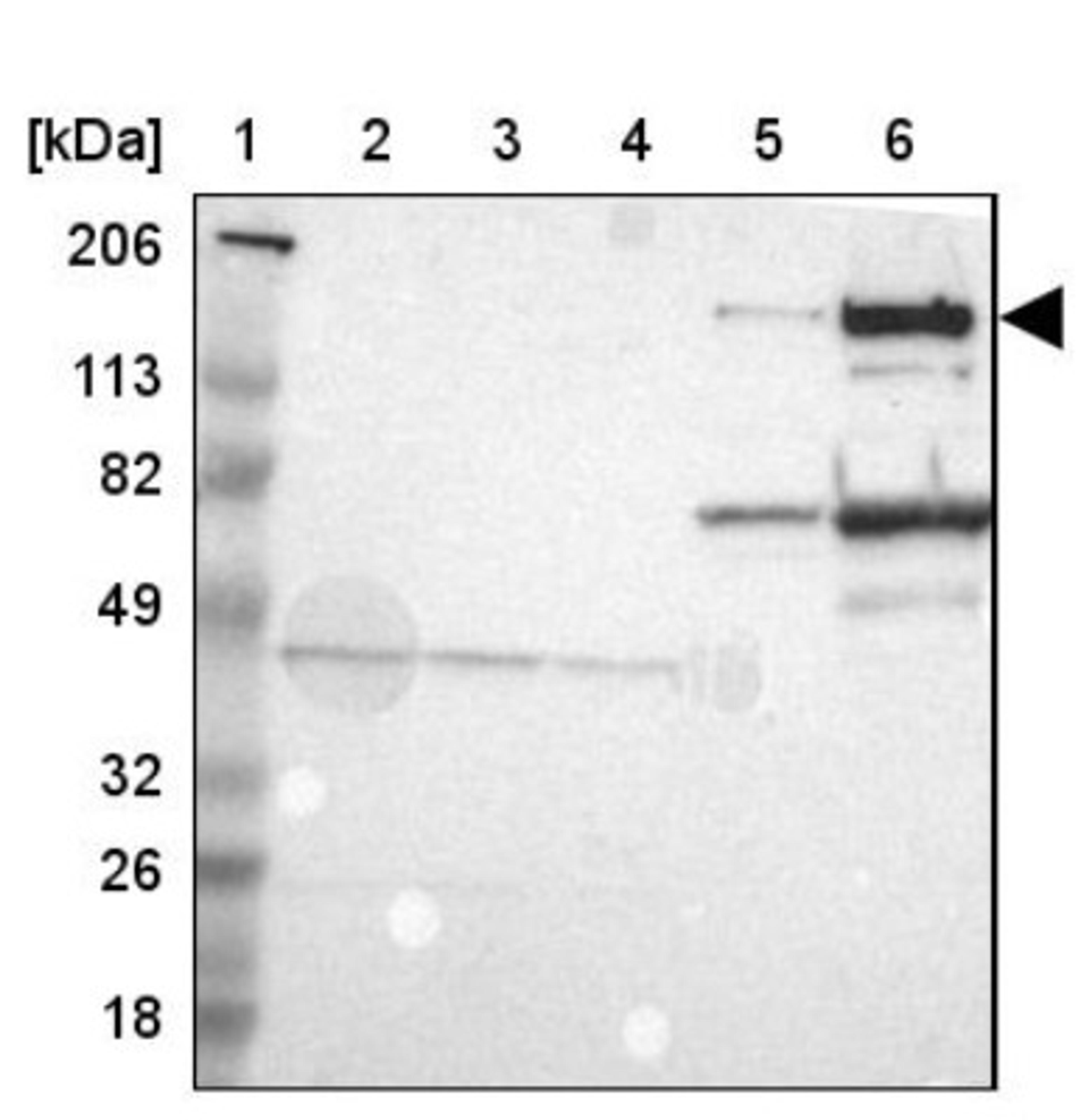 Western Blot: Alpha 2 Macroglobulin Antibody [NBP1-85491] - Lane 1: Marker [kDa] 206, 113, 82, 49, 32, 26, 18<br/>Lane 2: Human cell line RT-4<br/>Lane 3: Human cell line U-251MG sp<br/>Lane 4: Human cell line A-431<br/>Lane 5: Human liver tissue<br/>Lane 6: Human tonsil tissue