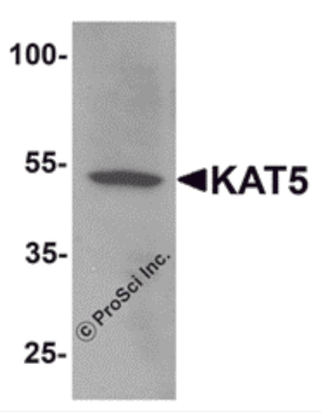 Western blot analysis of KAT5 in human brain tissue lysate with KAT5 antibody at 1 &#956;g/mL.