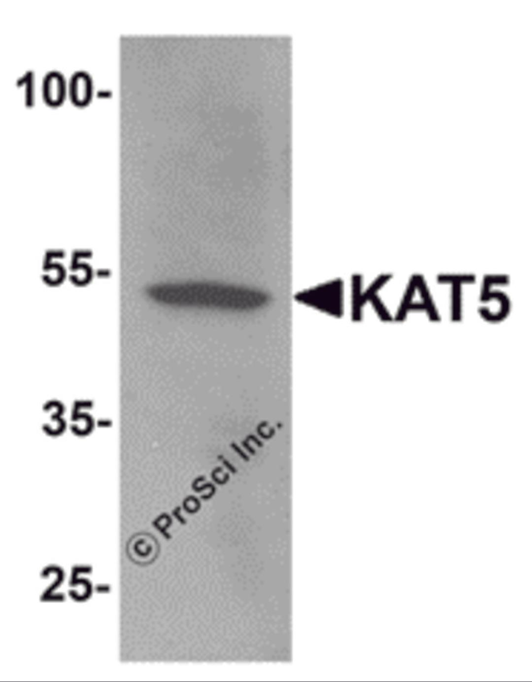 Western blot analysis of KAT5 in human brain tissue lysate with KAT5 antibody at 1 μg/mL.