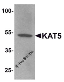Western blot analysis of KAT5 in human brain tissue lysate with KAT5 antibody at 1 μg/mL.