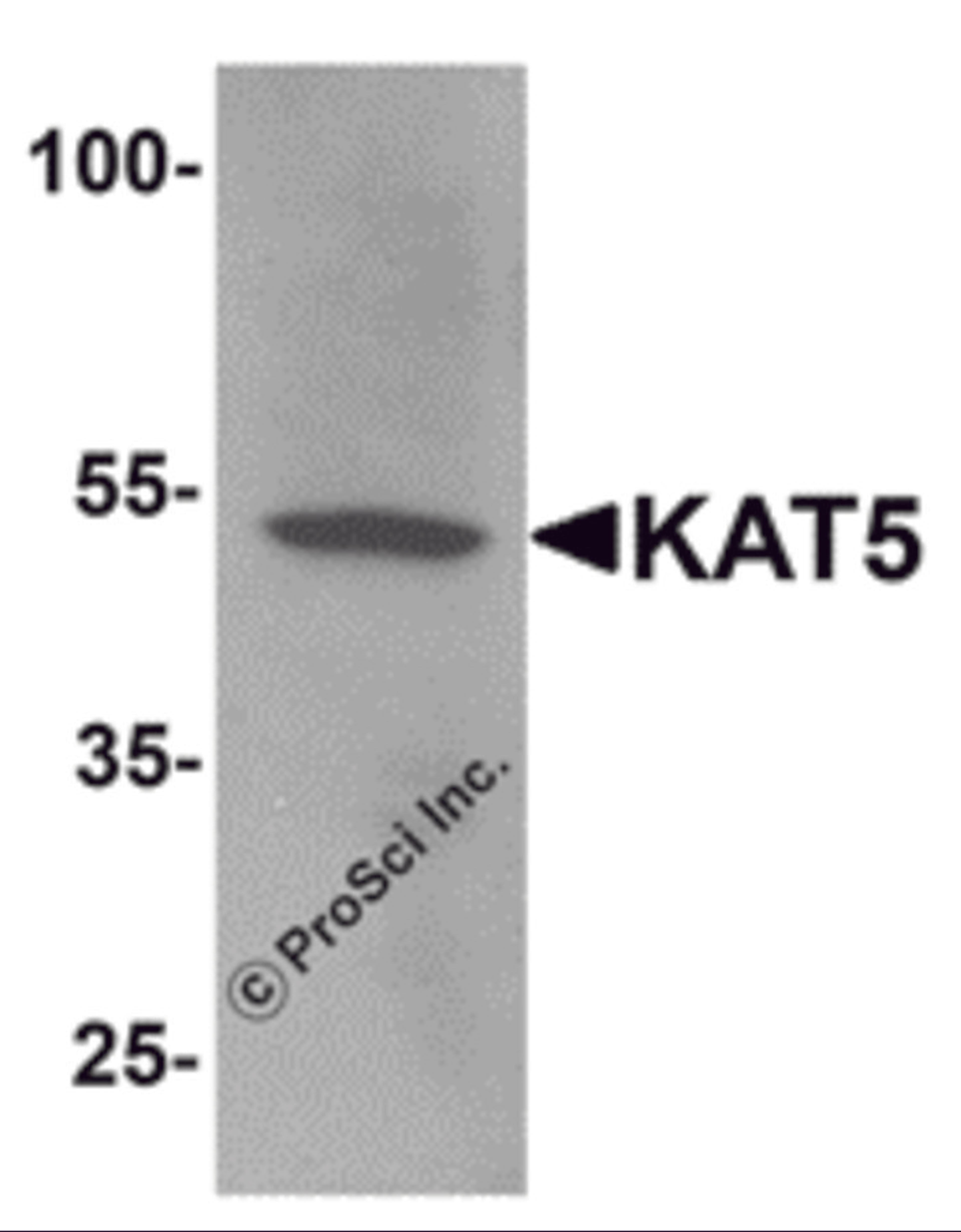 Western blot analysis of KAT5 in human brain tissue lysate with KAT5 antibody at 1 μg/mL.