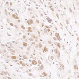 Detection of human RIF1 by immunohistochemistry.