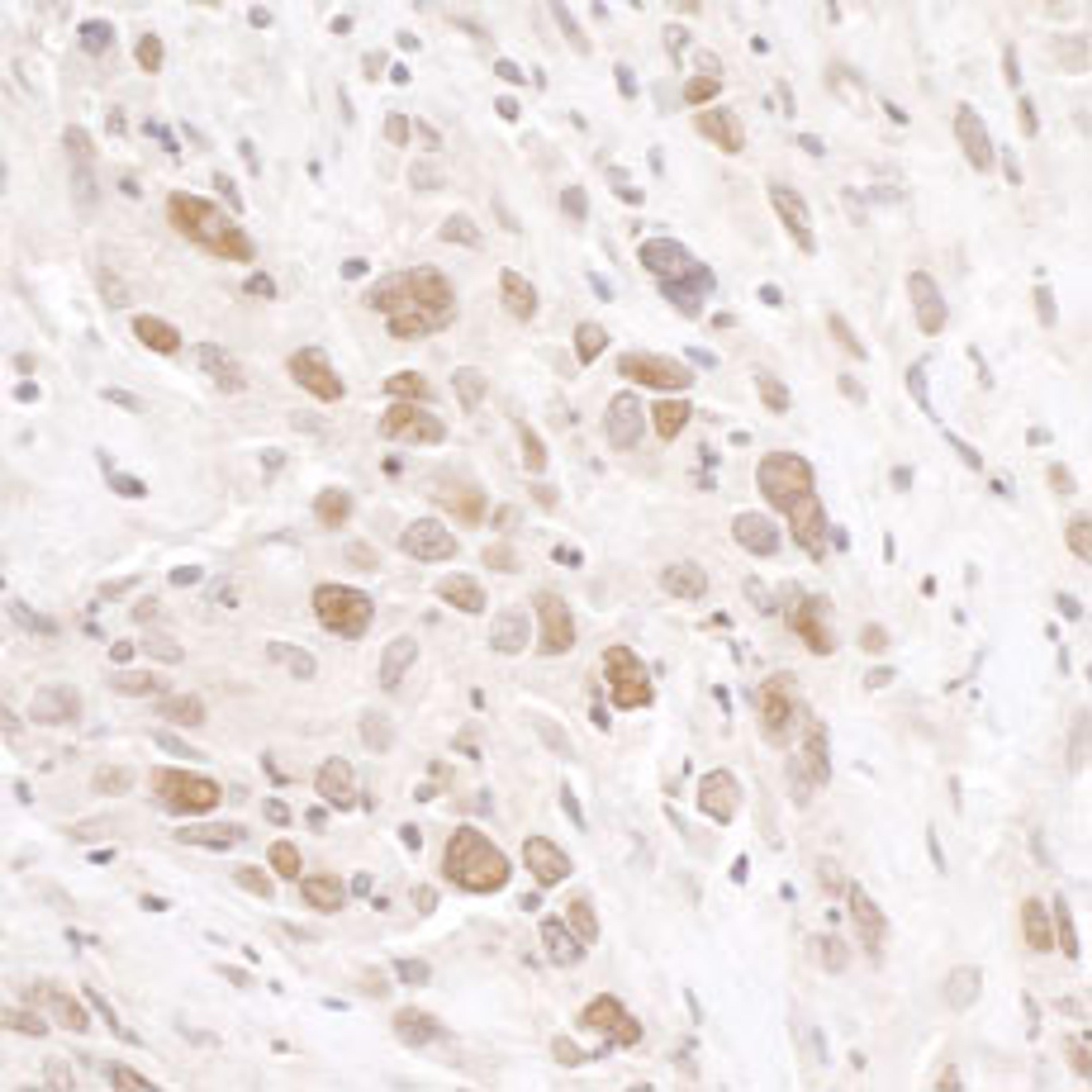 Detection of human RIF1 by immunohistochemistry.