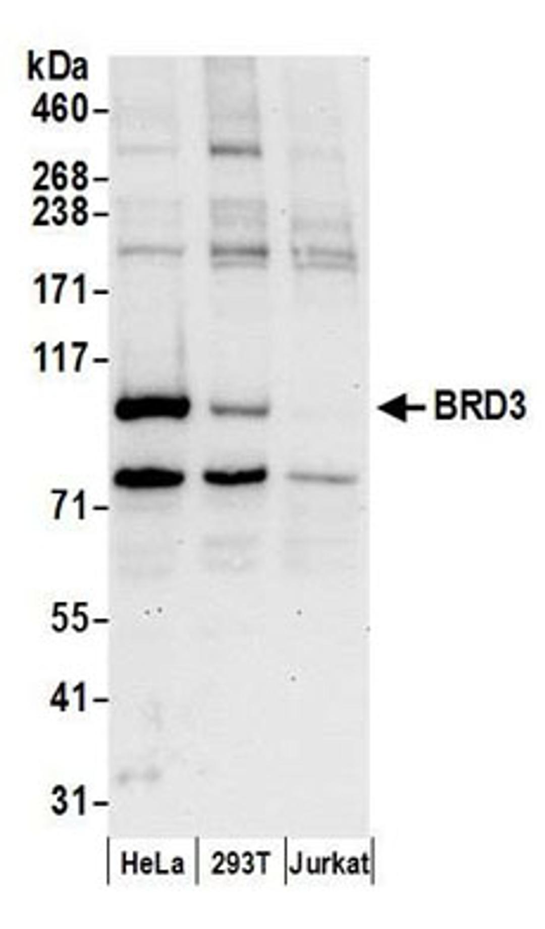 Detection of human BRD3 by western blot.