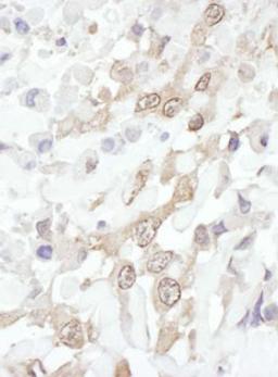 Detection of human ROC1 by immunohistochemistry.