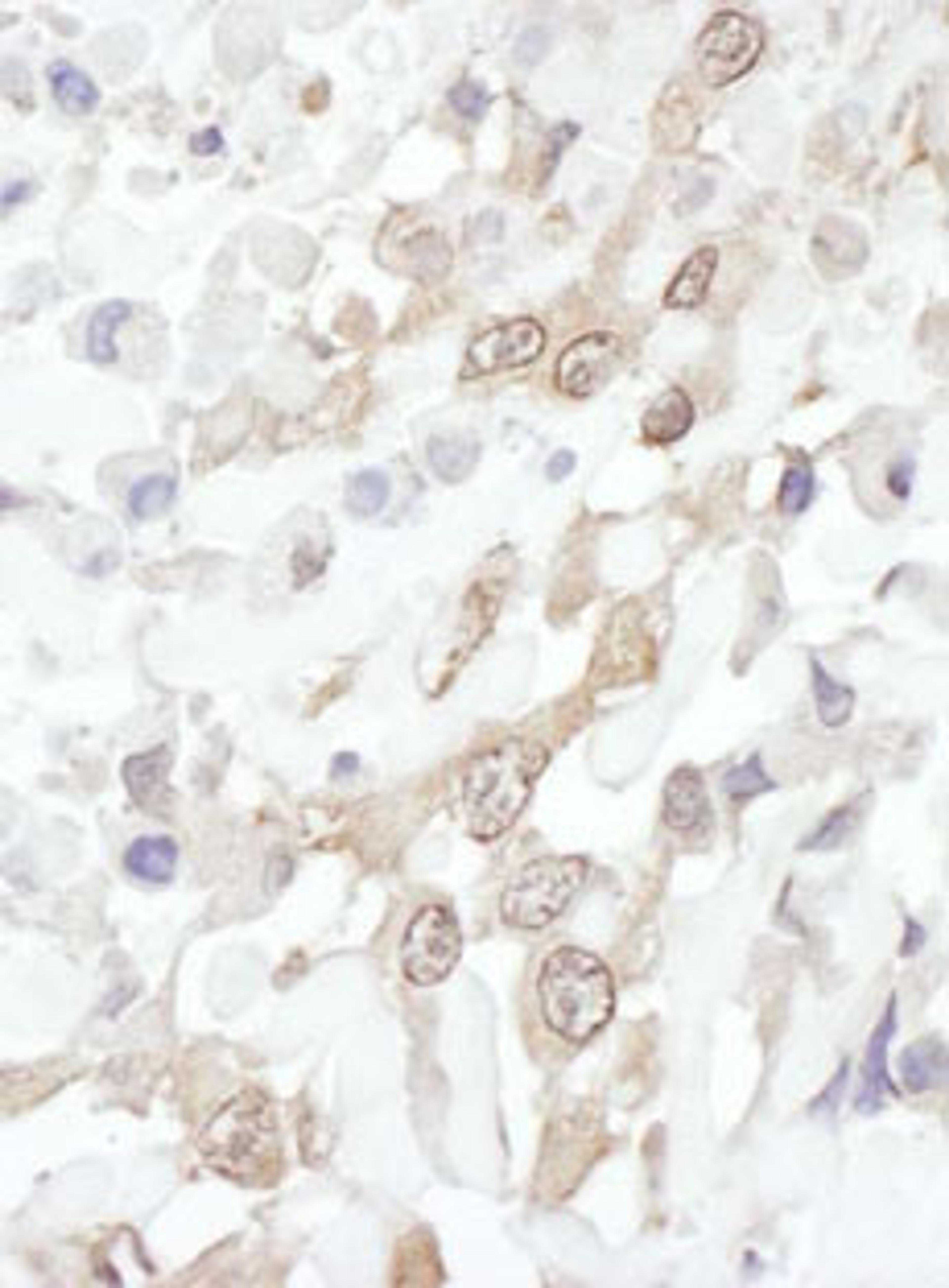 Detection of human ROC1 by immunohistochemistry.