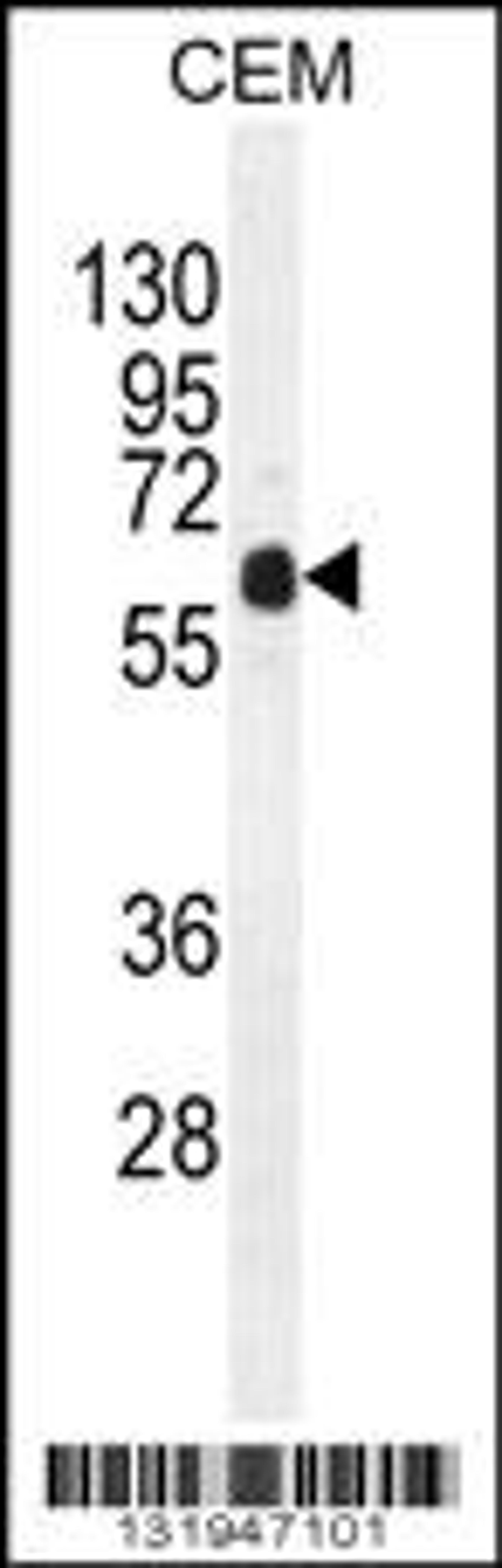 Western blot analysis in CEM cell line lysates (35ug/lane).