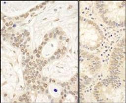 Detection of human FAF1 by immunohistochemistry.