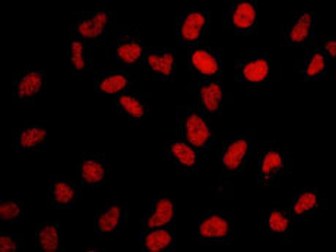 Detection of human BRD2 by immunocytochemistry.