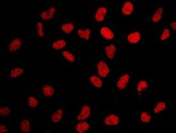 Detection of human BRD2 by immunocytochemistry.