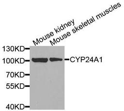 Western blot analysis of extracts of various cells using CYP24A1 antibody