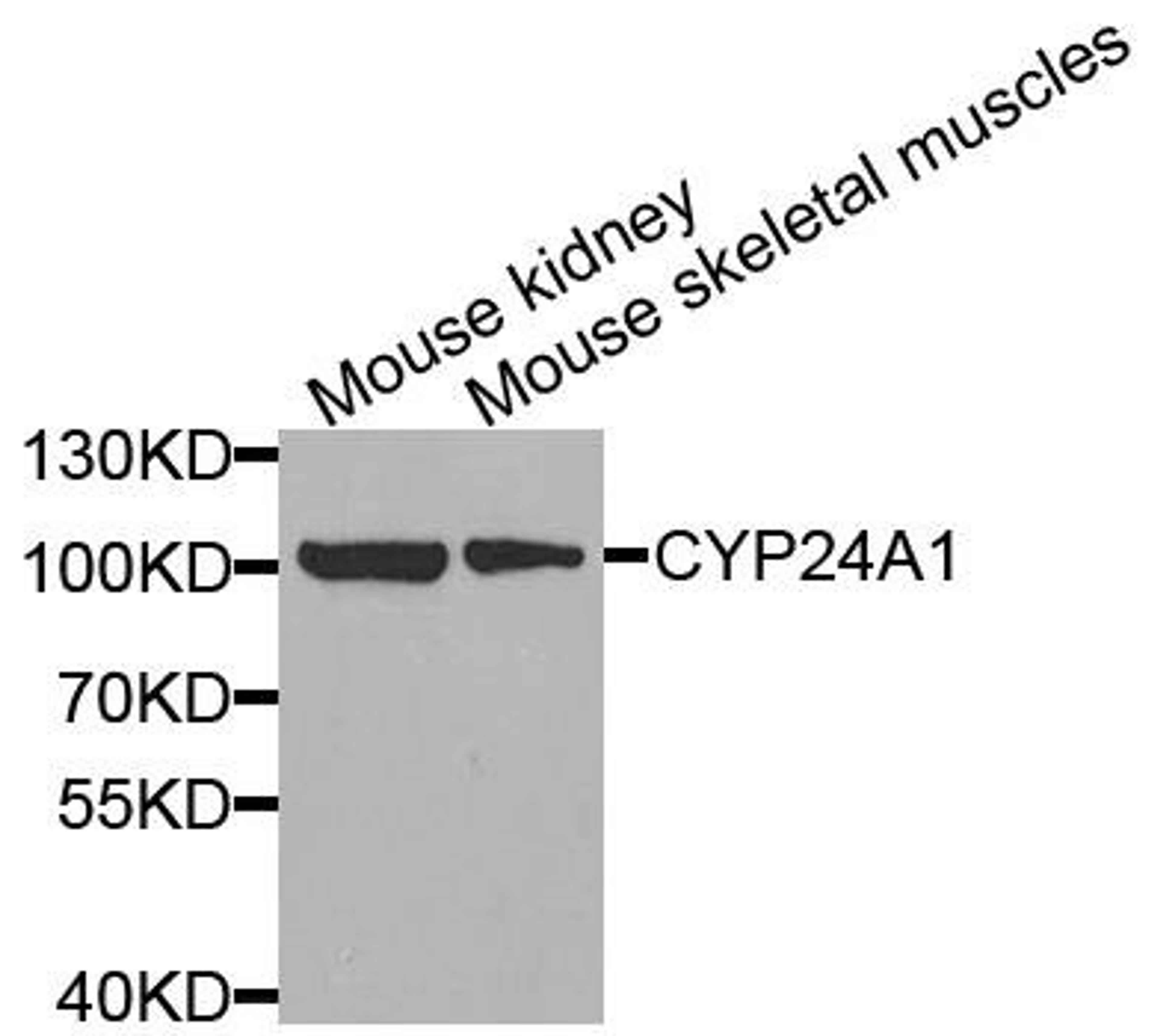 Western blot analysis of extracts of various cells using CYP24A1 antibody