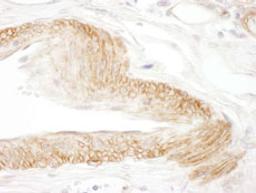 Detection of human JAM-C by immunohistochemistry.