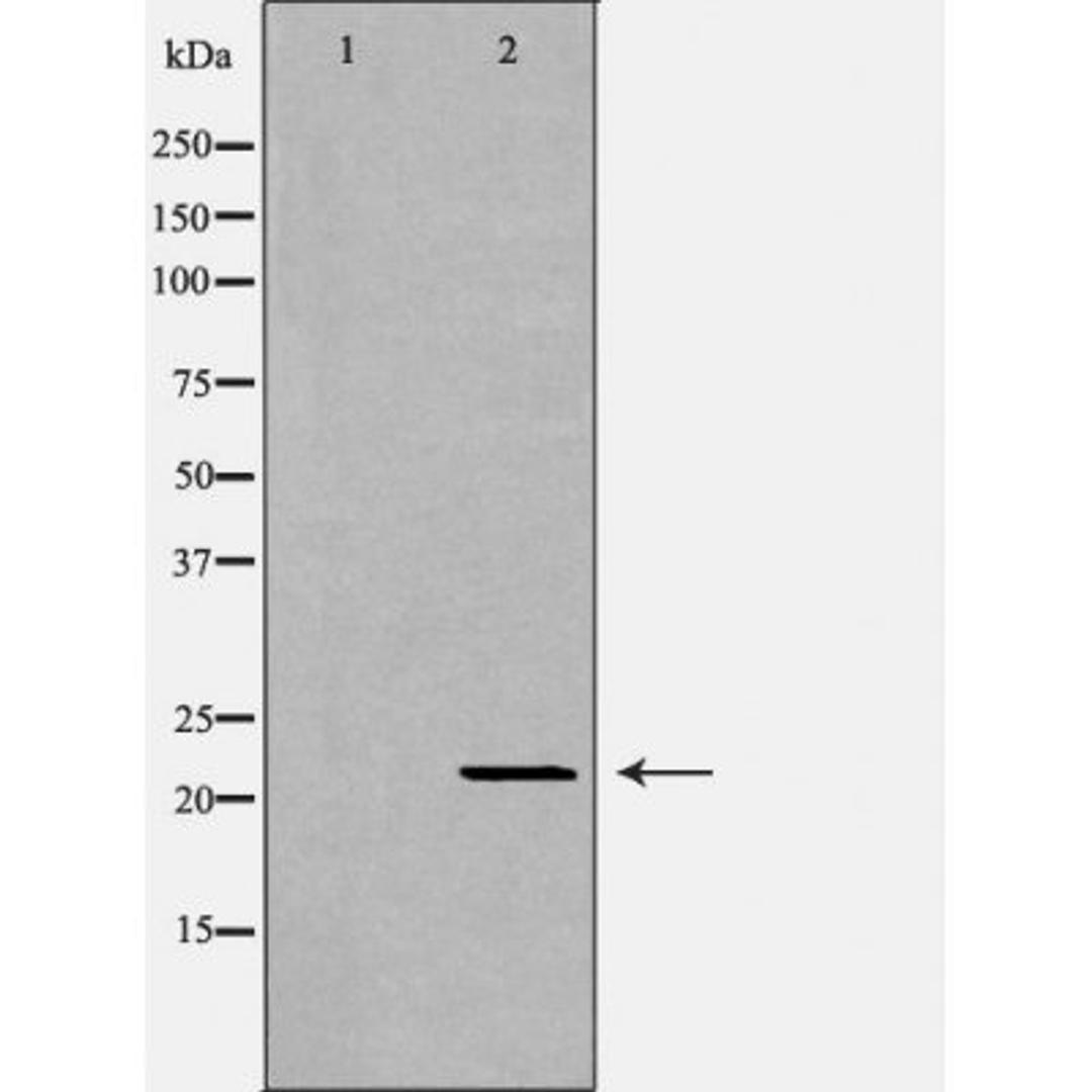 Western blot analysis of mouse livertissue using IFN-Alpha antibody