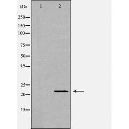 Western blot analysis of mouse livertissue using IFN-Alpha antibody