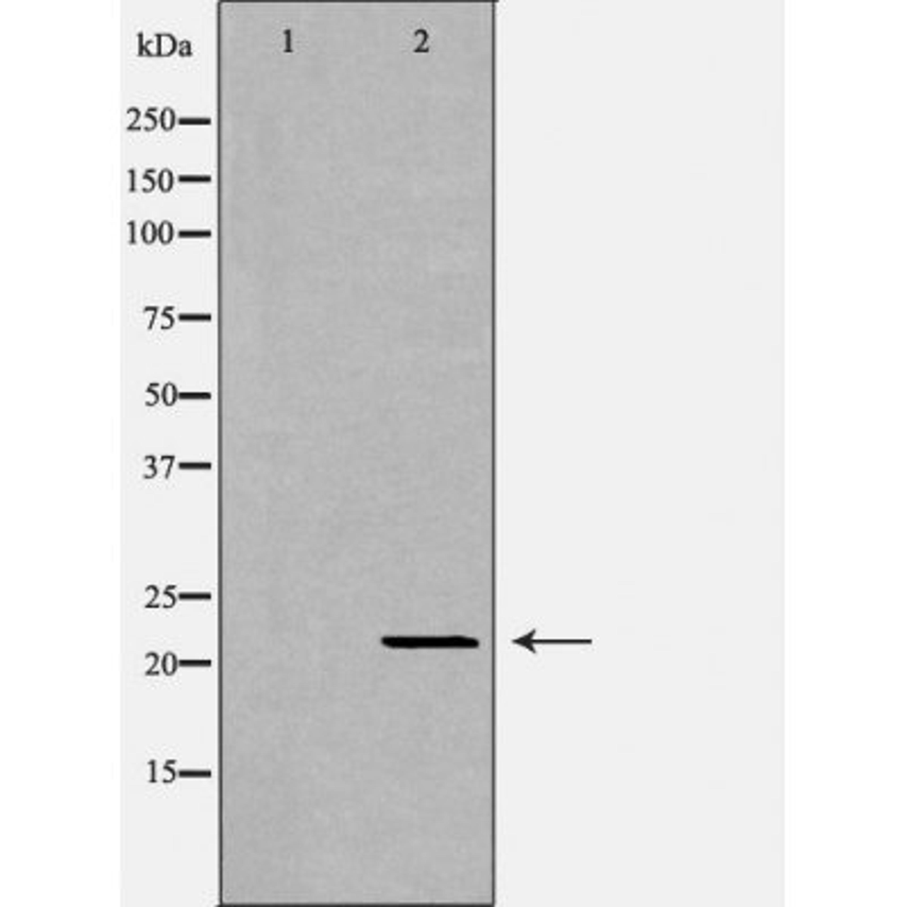 Western blot analysis of mouse livertissue using IFN-Alpha antibody