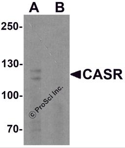 Western blot analysis of CASR in EL4 cell lysate with CASR antibody at 1 μg/ml in (A) the absence and (B) the presence of blocking peptide.