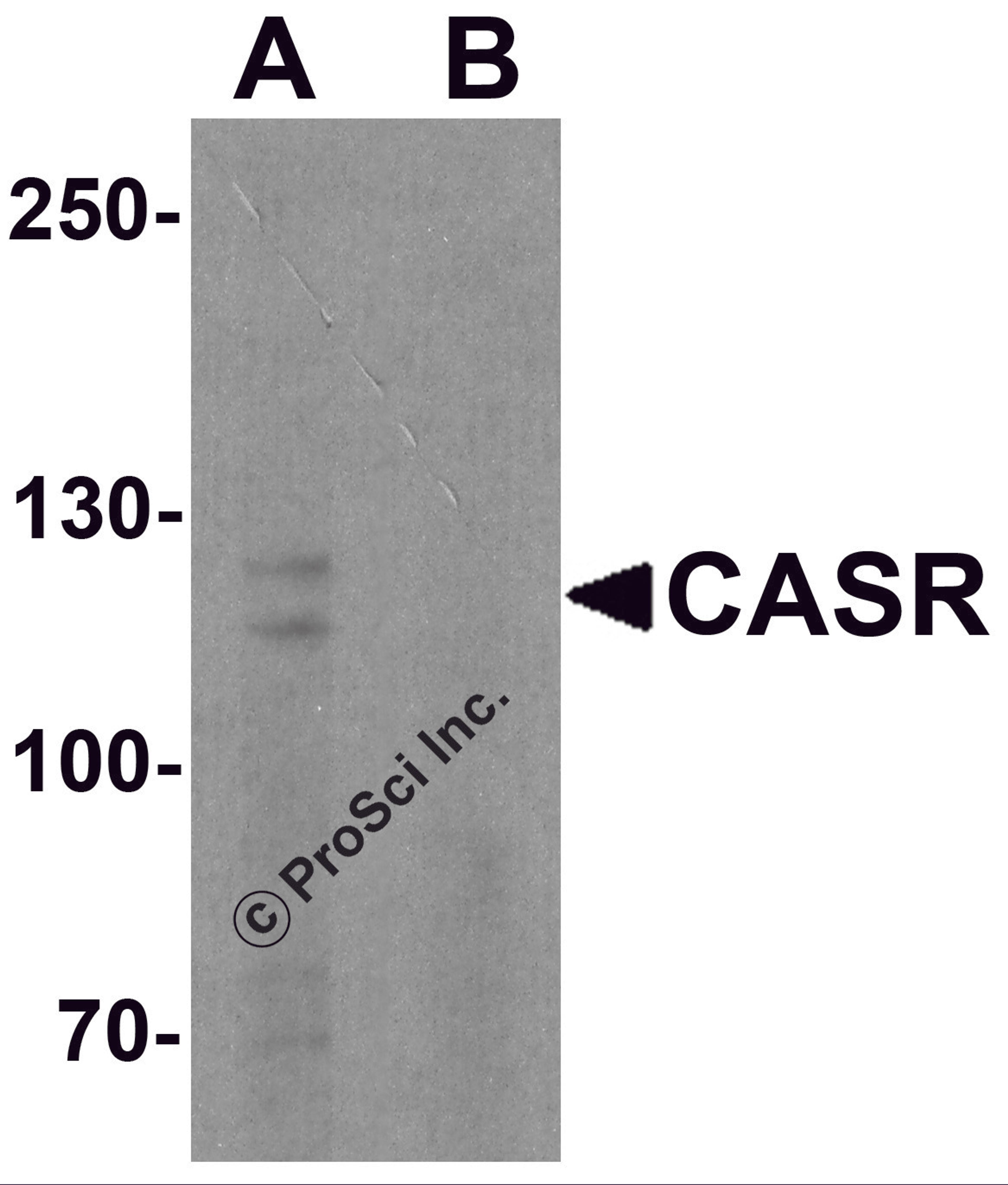 Western blot analysis of CASR in EL4 cell lysate with CASR antibody at 1 μg/ml in (A) the absence and (B) the presence of blocking peptide.