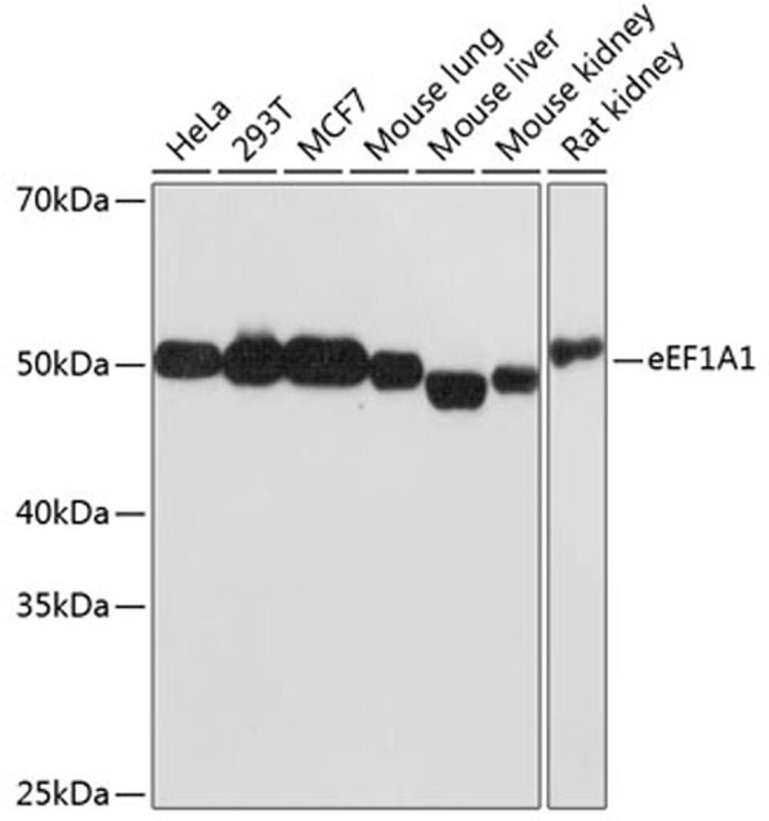 Western blot - eEF1A1 Rabbit mAb (A11545)