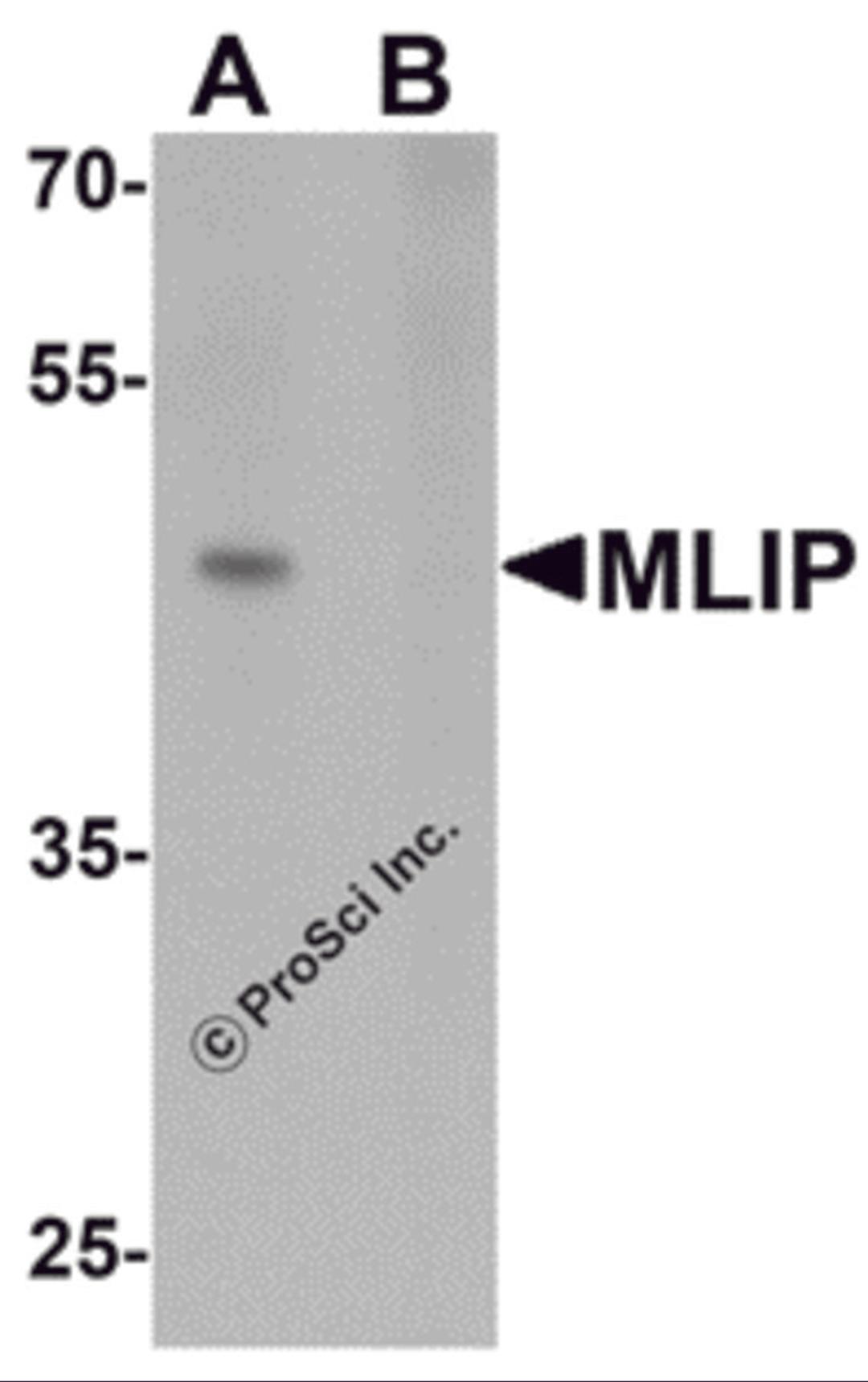 Western blot analysis of MLIP in 293 cell lysate with MLIP antibody at 1 μg/mL in (A) the absence and (B) the presence of blocking peptide.