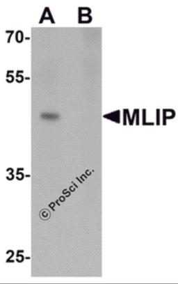 Western blot analysis of MLIP in 293 cell lysate with MLIP antibody at 1 μg/mL in (A) the absence and (B) the presence of blocking peptide.
