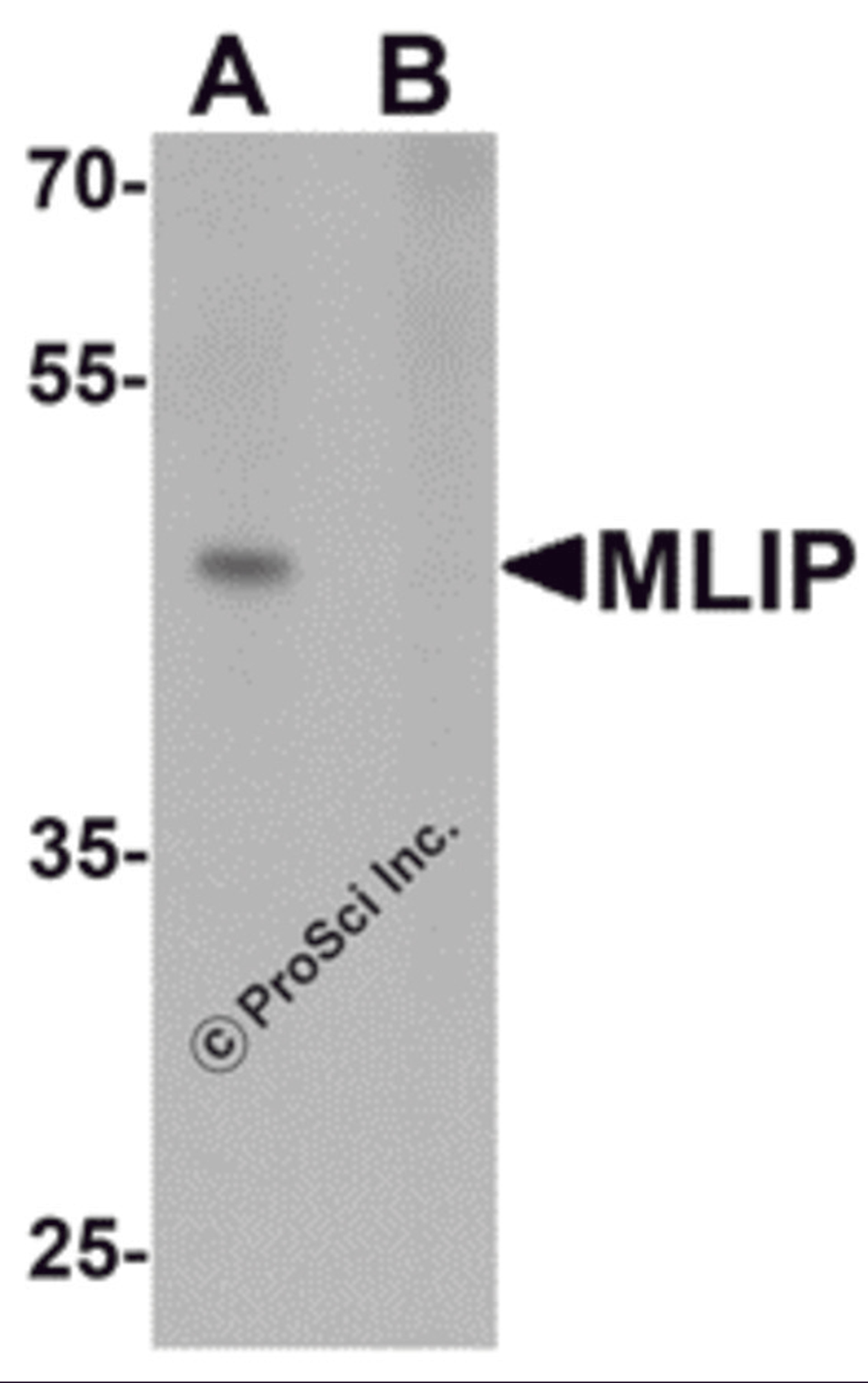 Western blot analysis of MLIP in 293 cell lysate with MLIP antibody at 1 μg/mL in (A) the absence and (B) the presence of blocking peptide.