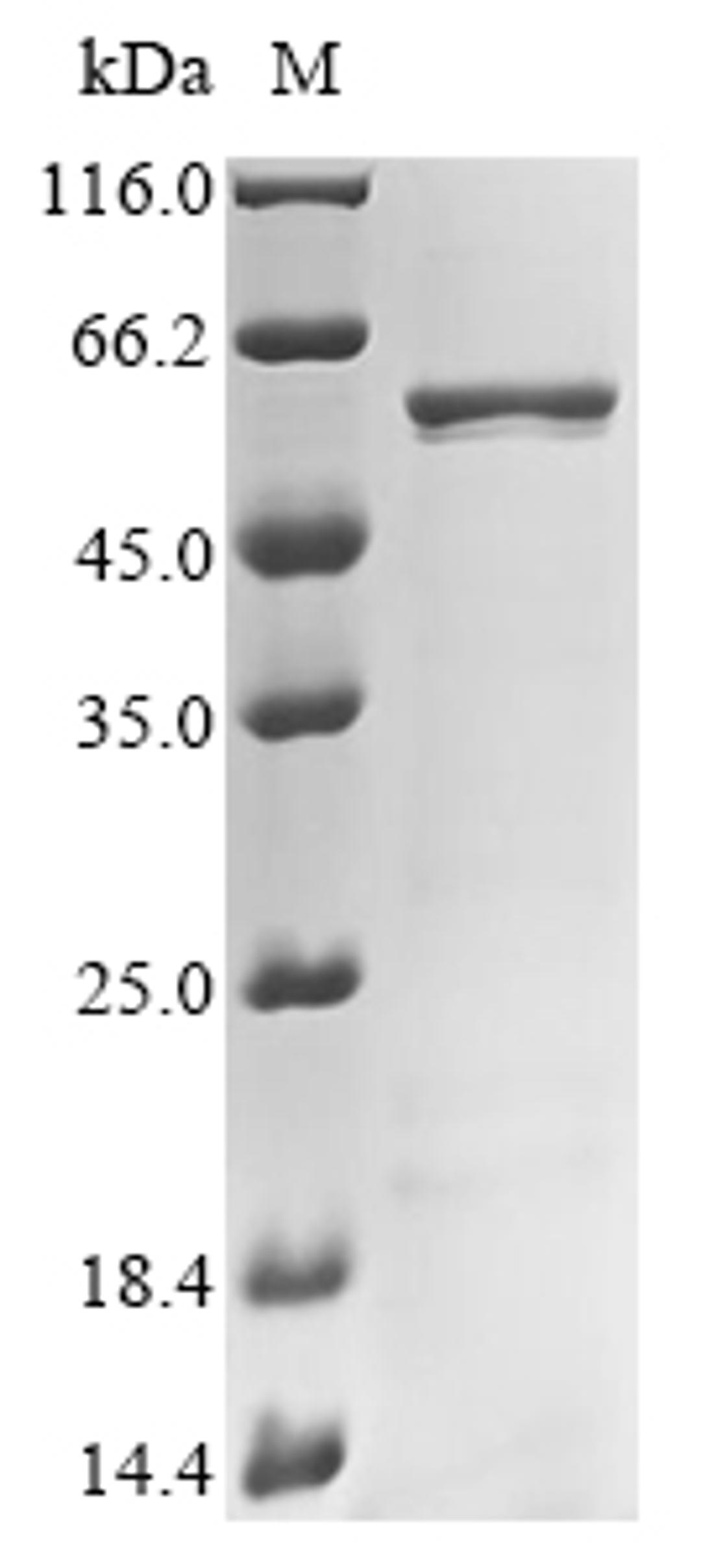 (Tris-Glycine gel) Discontinuous SDS-PAGE (reduced) with 5% enrichment gel and 15% separation gel.